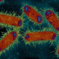 Infection Urinaire Une cystite est une inflammation de la vessie, le plus souvent d’origine bactérienne, la principale responsable étant la bactérie intestinale Escherichia Coli.