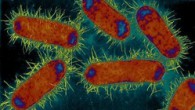 Une cystite est une inflammation de la vessie, le plus souvent d’origine bactérienne, la principale responsable étant la bactérie intestinale Escherichia Coli.